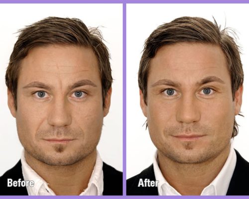 before_after_large_3-1